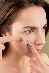 What are Papules? Early signs and Risks